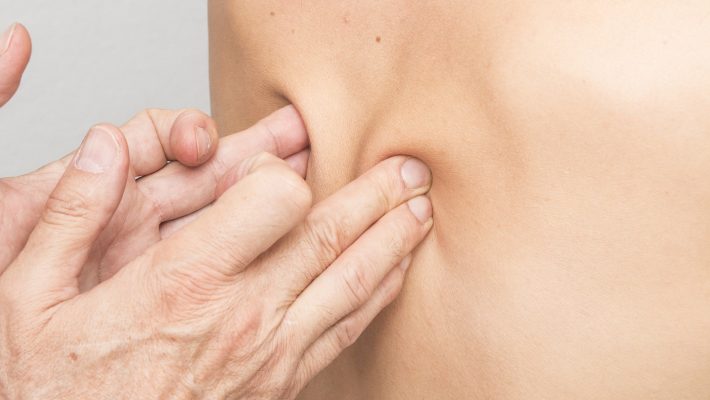 Nowa metoda szybkiej walki z bólem – terapia FDM